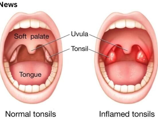 Can tonsils grow back after being removed? – tymoff