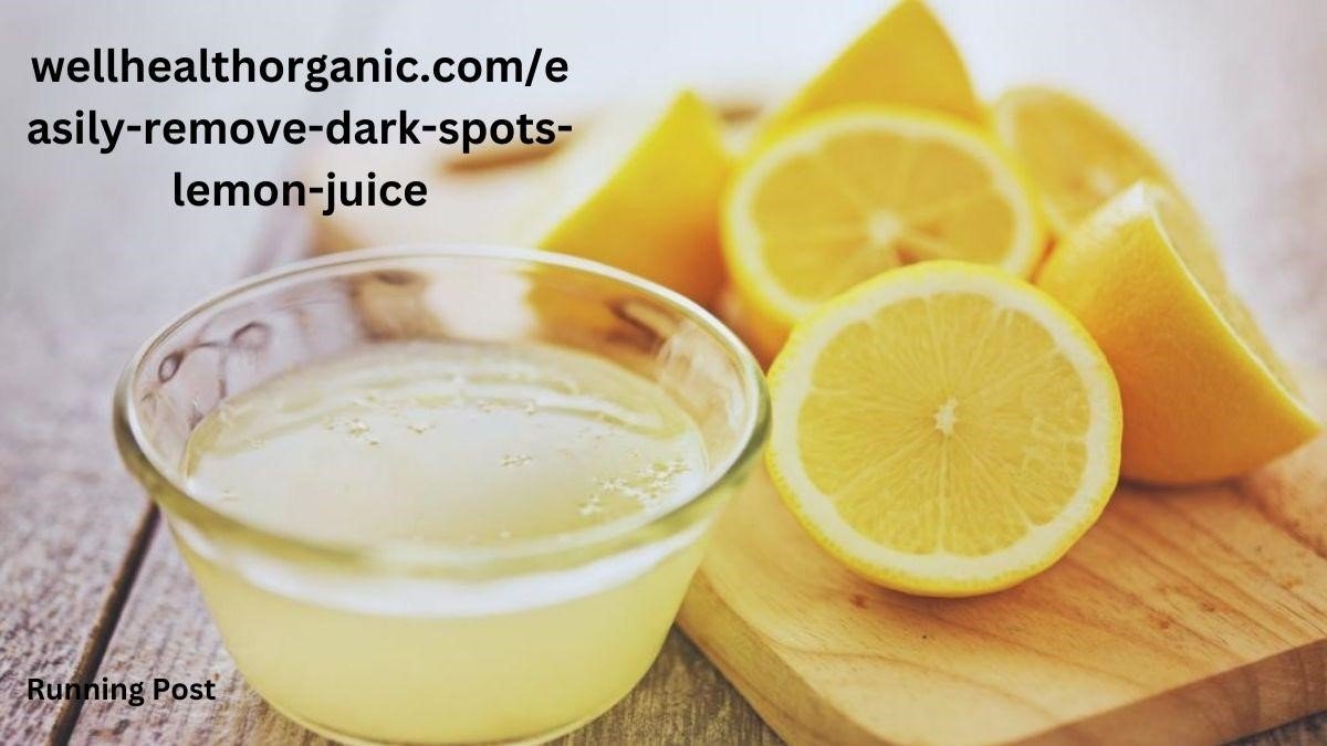 wellhealthorganic.com/easily-remove-dark-spots-lemon-juice